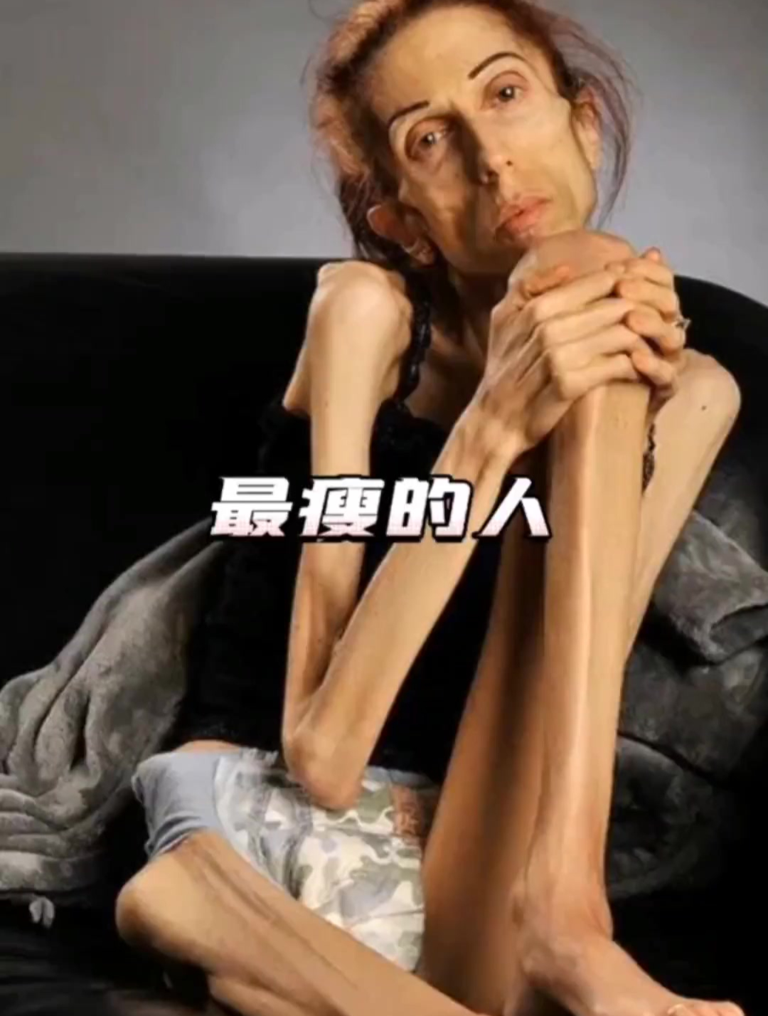 妖怪瘦