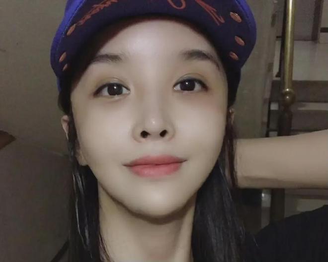 河莉秀整容
