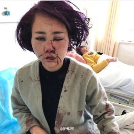 丽江打人毁容事件公关计划