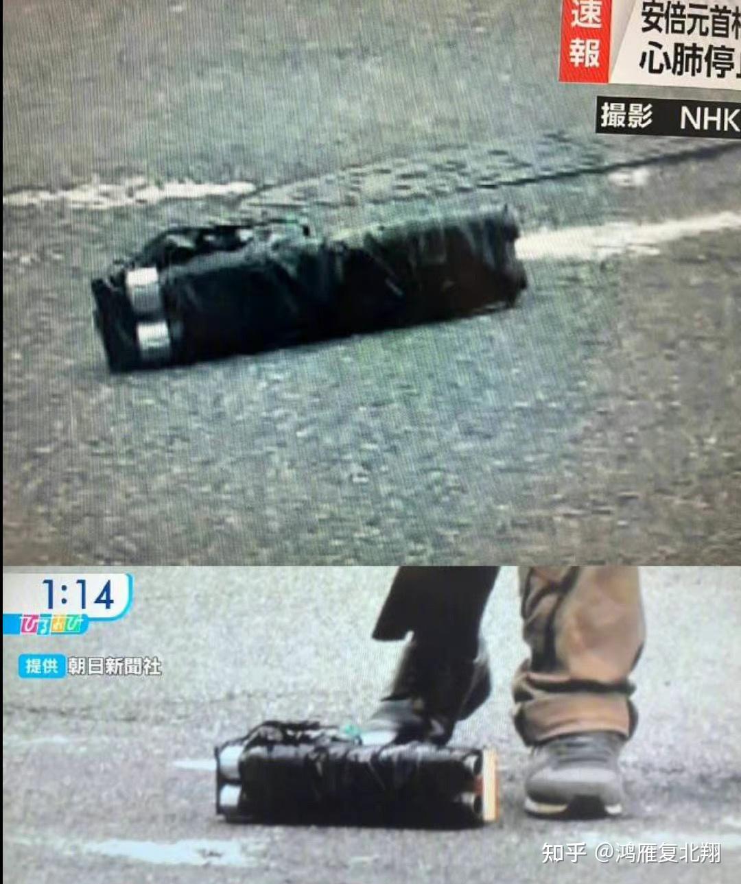 关于安倍晋三胸部中枪的信息
