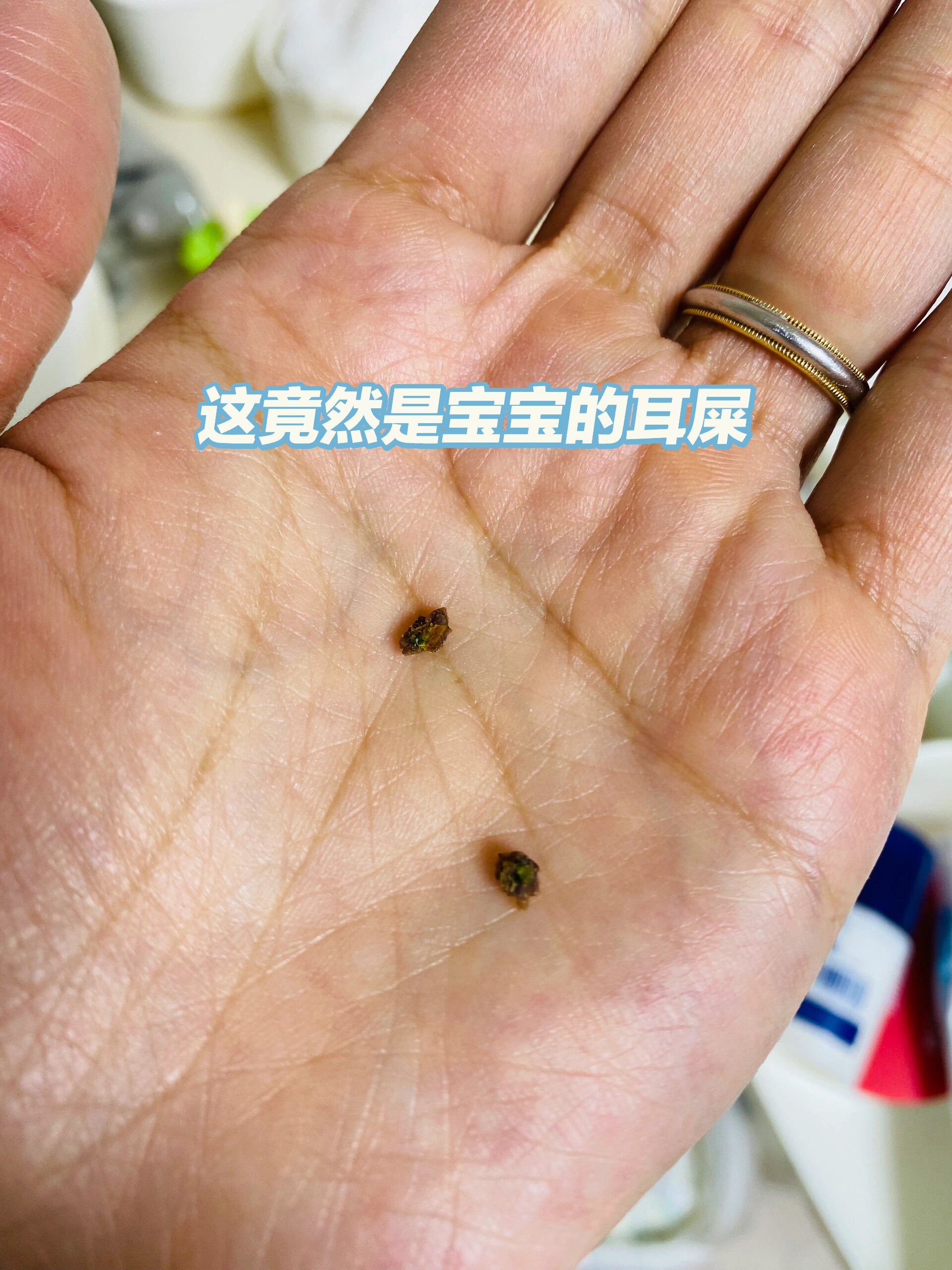 梦见耳屎