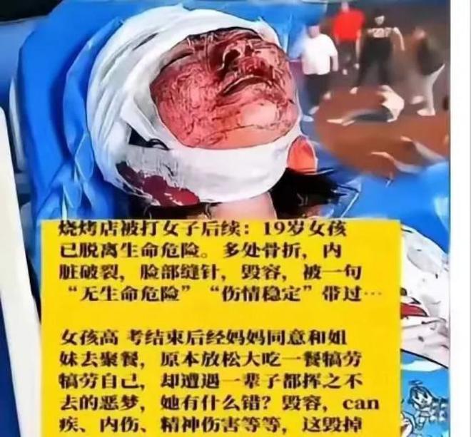 云南打人毁容事件
