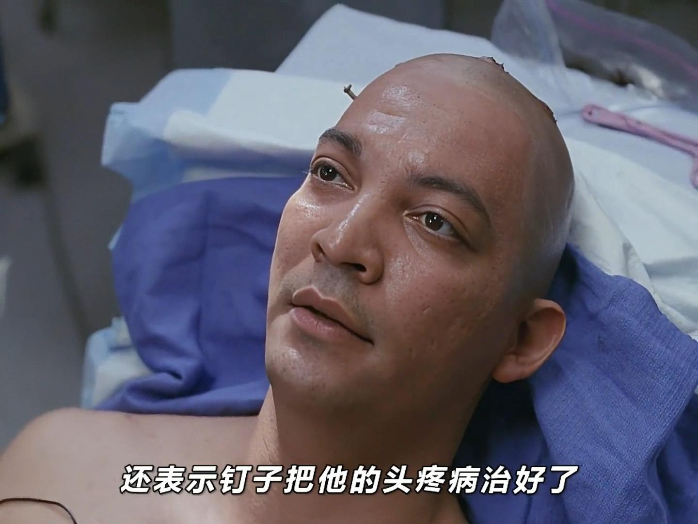 婴儿天灵盖