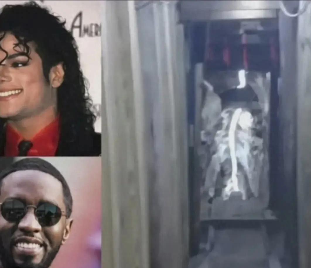 michaeljackson死因